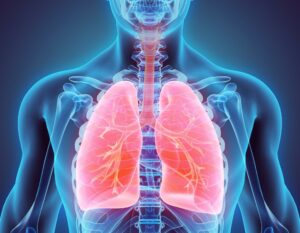 Can Peritoneal Mesothelioma Spread To The Lungs Pintas Mullins Law Firm