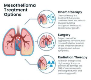 Mesothelioma Treatment Surgery Chemotherapy Emerging Treatments